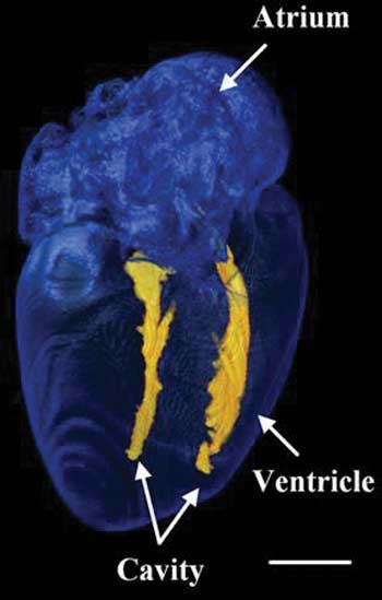 Image of a heart